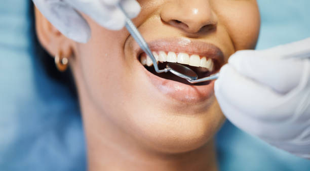 Best Knocked-Out Tooth Emergency  in Oroville, CA